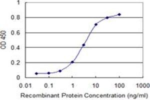 Detection limit for recombinant GST tagged UPF1 is 0. (RENT1/UPF1 antibody  (AA 1019-1116))