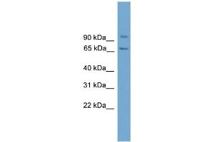 WB Suggested Anti-LOH11CR2A Antibody Titration: 0. (VWA5A antibody  (N-Term))