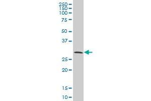 CITED1 monoclonal antibody (M02), clone 6C1 Western Blot analysis of CITED1 expression in A-431 (CITED1 antibody  (AA 94-193))