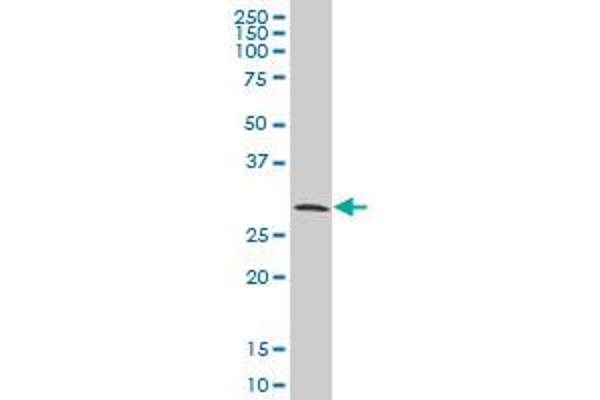 CITED1 antibody  (AA 94-193)