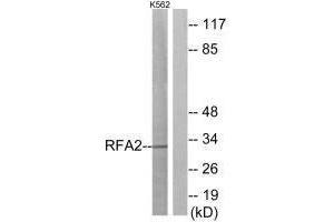 Western blot analysis of extracts from K562 cells, using RFA2 (Ab-21) antibody. (RPA2 antibody  (Thr21))
