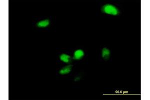 Immunofluorescence of purified MaxPab antibody to YBX2 on HeLa cell.