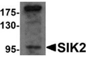 Western blot analysis of SIK2 in SW480 cell lysate with SIK2 antibody at 1 μg/ml.