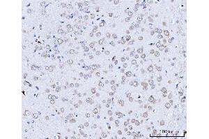 IHC analysis of TARS2 using anti-TARS2 antibody (ABIN7602308).