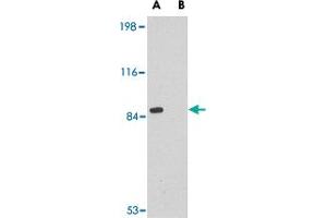 Western blot analysis of RIMS2 in rat brain tissue lysate with RIMS2 polyclonal antibody  at 1 ug/mL in the (A) absence or (B) presence of blocking peptide. (RIMS2 antibody  (Internal Region))