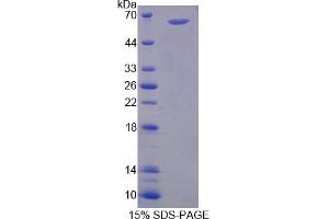 Image no. 1 for Peptidyl Arginine Deiminase, Type II (PADI2) (AA 1-300) protein (His tag,GST tag) (ABIN6237465) (PADI2 Protein (AA 1-300) (His tag,GST tag))