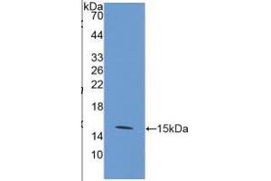 Western Blotting (WB) image for Solute Carrier Family 2 (Facilitated Glucose Transporter), Member 1 (SLC2A1) ELISA Kit (ABIN6574259)