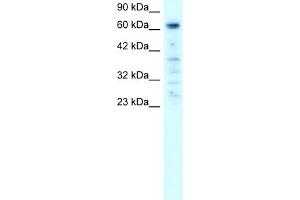WB Suggested Anti-PAntibody Titration:  0. (PARP3 antibody  (C-Term))