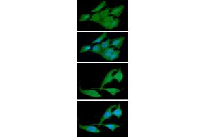 ICC/IF analysis of CRADD in HeLa cells line, stained with DAPI (Blue) for nucleus staining and monoclonal anti-human CRADD antibody (1:100) with goat anti-mouse IgG-Alexa fluor 488 conjugate (Green). (CRADD antibody)