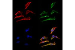ABIN6263296 and ABIN6266592 staining Hela cells by IF/ICC. (MMP15 antibody  (C-Term))