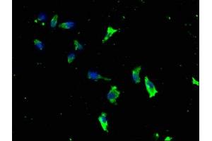 Immunofluorescence staining of SH-SY5Y cells with ABIN7157554 at 1:133, counter-stained with DAPI. (KSR1 antibody  (AA 404-598))
