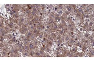Immunohistochemistry (IHC) image for anti-Olfactory Receptor, Family 7, Subfamily E, Member 24 (OR7E24) antibody (ABIN6259544)
