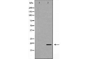 Western blot analysis of Hela whole cell lysates, using UBE2C Antibody. (UBE2C antibody  (C-Term))