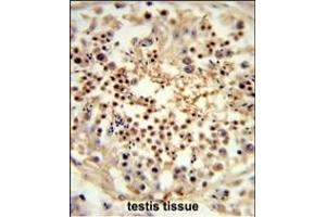 Formalin-fixed and paraffin-embedded human testis tissue reacted with UN Antibody (Center) (ABIN653320 and ABIN2842812) , which was peroxidase-conjugated to the secondary antibody, followed by DAB staining. (UNC119 antibody  (AA 64-94))