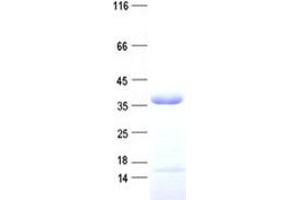 Validation with Western Blot (Nth Endonuclease III-Like 1 (NTHL1) protein (His tag))