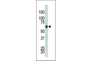 The anti-PCTK3 Pab (ABIN391790 and ABIN2841646) is used in Western blot to detect PCTK3 in HL-60 cell lysate. (CDK18 antibody  (N-Term))