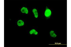 Immunofluorescence of monoclonal antibody to ZBED1 on HeLa cell. (ZBED1 antibody  (AA 3-99))