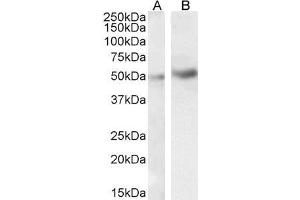 ABIN185338 (1µg/ml) staining of HeLa (A) and Jurkat (B) cell lysate (35µg protein in RIPA buffer). (IRAK4 antibody  (N-Term))
