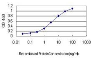 Detection limit for recombinant GST tagged POMC is approximately 0. (POMC antibody  (AA 205-267))