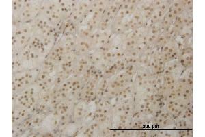 Immunoperoxidase of monoclonal antibody to RAX on formalin-fixed paraffin-embedded human adrenal gland. (RAX antibody  (AA 104-206))