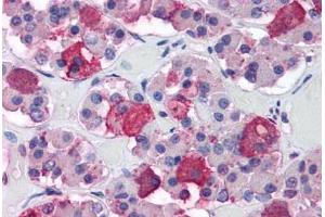 Human Pituitary (formalin-fixed, paraffin-embedded) stained with POMC antibody ABIN364371 at 5 ug/ml followed by biotinylated anti-mouse IgG secondary antibody ABIN481714, alkaline phosphatase-streptavidin and chromogen. (ACTH antibody  (N-Term))