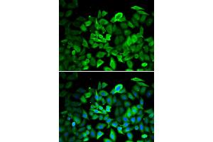 Immunofluorescence analysis of HeLa cells using ANXA1 antibody. (Annexin a1 antibody)