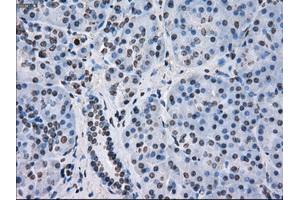 Immunohistochemical staining of paraffin-embedded colon tissue using anti-FKBP5mouse monoclonal antibody.