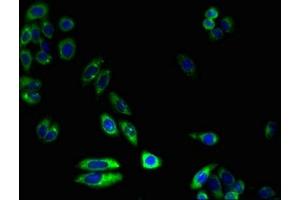 Immunofluorescent analysis of HepG2 cells using ABIN7149279 at dilution of 1:100 and Alexa Fluor 488-congugated AffiniPure Goat Anti-Rabbit IgG(H+L) (CYP4X1 antibody  (AA 35-300))