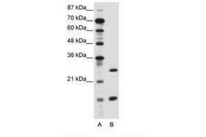 Image no. 1 for anti-CCAAT/enhancer Binding Protein (C/EBP), gamma (CEBPG) (AA 11-60) antibody (ABIN6736115)