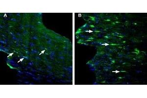 Expression of GPR84 in mouse fornix in a kainic acid-induced model of temporal lobe epilepsy - Immunohistochemical staining of perfusion-fixed frozen mouse brain sections with Anti-GPR84 (extracellular) Antibody (ABIN7043175, ABIN7044443 and ABIN7044444), (1:200), followed by goat anti-rabbit-AlexaFluor-488. (GPR84 antibody  (Extracellular))