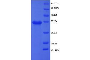SDS-PAGE (SDS) image for Pro-Platelet Basic Protein (Chemokine (C-X-C Motif) Ligand 7) (PPBP) (AA 59-125), (partial) protein (GST tag) (ABIN4976531) (CXCL7 Protein (AA 59-125, partial) (GST tag))