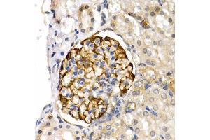 Immunohistochemistry of paraffin-embedded rat kidney using LIPG antibody (ABIN5975340) at dilution of 1/200 (40x lens). (LIPG antibody)