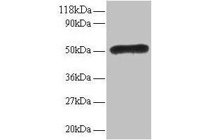 Western blot All lanes: LMO1 antibody at 2 μg/mL Lane 1: EC109 whole cell lysate Lane 2: 293T whole cell lysate Secondary Goat polyclonal to rabbit IgG at 1/15000 dilution Predicted band size: 18 kDa Observed band size: 50 kDa (LMO1 antibody  (AA 5-156))