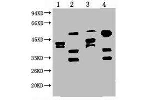 Western blot analysis of 1) Hela, 2) HepG2, 3) 293T, 4) Jurkat, diluted at 1:2000. (ERCC1 antibody)