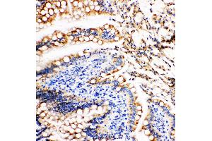 Anti-Vinculin antibody, IHC(P) IHC(P): Rat Intestine Tissue