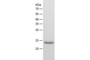 ASPRV1 Protein (AA 191-326) (His tag)