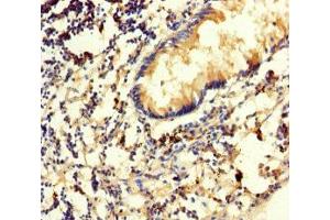 Immunohistochemistry of paraffin-embedded human appendix tissue using ABIN7170541 at dilution of 1:100 (Spermidine Synthase antibody  (AA 17-302))
