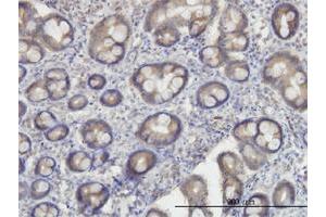 Immunoperoxidase of monoclonal antibody to OXSR1 on formalin-fixed paraffin-embedded human small Intestine. (OXSR1 antibody  (AA 1-527))
