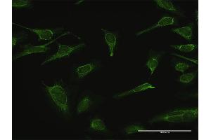 Immunofluorescence of purified MaxPab antibody to IMPA1 on HeLa cell.