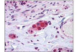 Human Small Intestine, Submucosal Plexus: Formalin-Fixed, Paraffin-Embedded (FFPE) (ZEB2 antibody  (C-Term))