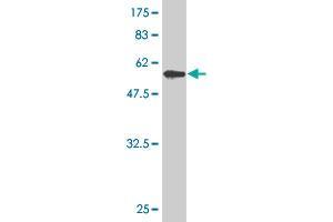 Western Blot detection against Immunogen (59. (ZNF215 antibody  (AA 1-304))