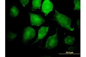 Image no. 3 for anti-Inhibitor of kappa Light Polypeptide Gene Enhancer in B-Cells, Kinase gamma (IKBKG) (AA 1-420) antibody (ABIN599042) (IKBKG antibody  (AA 1-420))