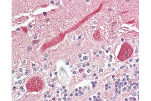 Anti-FADS1 antibody IHC staining of human brain, cerebellum. (FADS1 antibody  (AA 303-332))