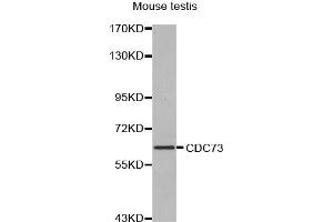 Western blot analysis of extracts of mouse testis, using CDC73 antibody (ABIN5970235).