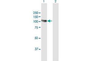 Western Blot analysis of ADD2 expression in transfected 293T cell line by ADD2 MaxPab polyclonal antibody. (ADD2 antibody  (AA 1-726))