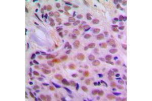 Immunohistochemistry (IHC) image for anti-Checkpoint Kinase 2 (CHEK2) (N-Term) antibody (ABIN7297888)