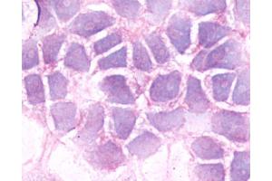 Anti-BDKRB2 / BK-2 antibody immunocytochemistry (ICC) staining of untransfected HEK293 human embryonic kidney cells. (BDKRB2 antibody  (C-Term))