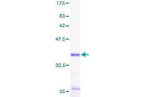 SAA1 Protein (AA 1-122) (GST tag)