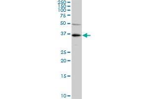 KLF7 monoclonal antibody (M01), clone 3E8-B8. (KLF7 antibody  (AA 1-230))