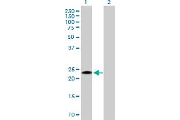 FGFBP1 anticorps  (AA 1-234)